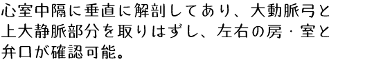 心室中隔に垂直に解剖してあり、大動脈弓と上大静脈部分を取りはずし、左右の房・室と弁口が確認可能。